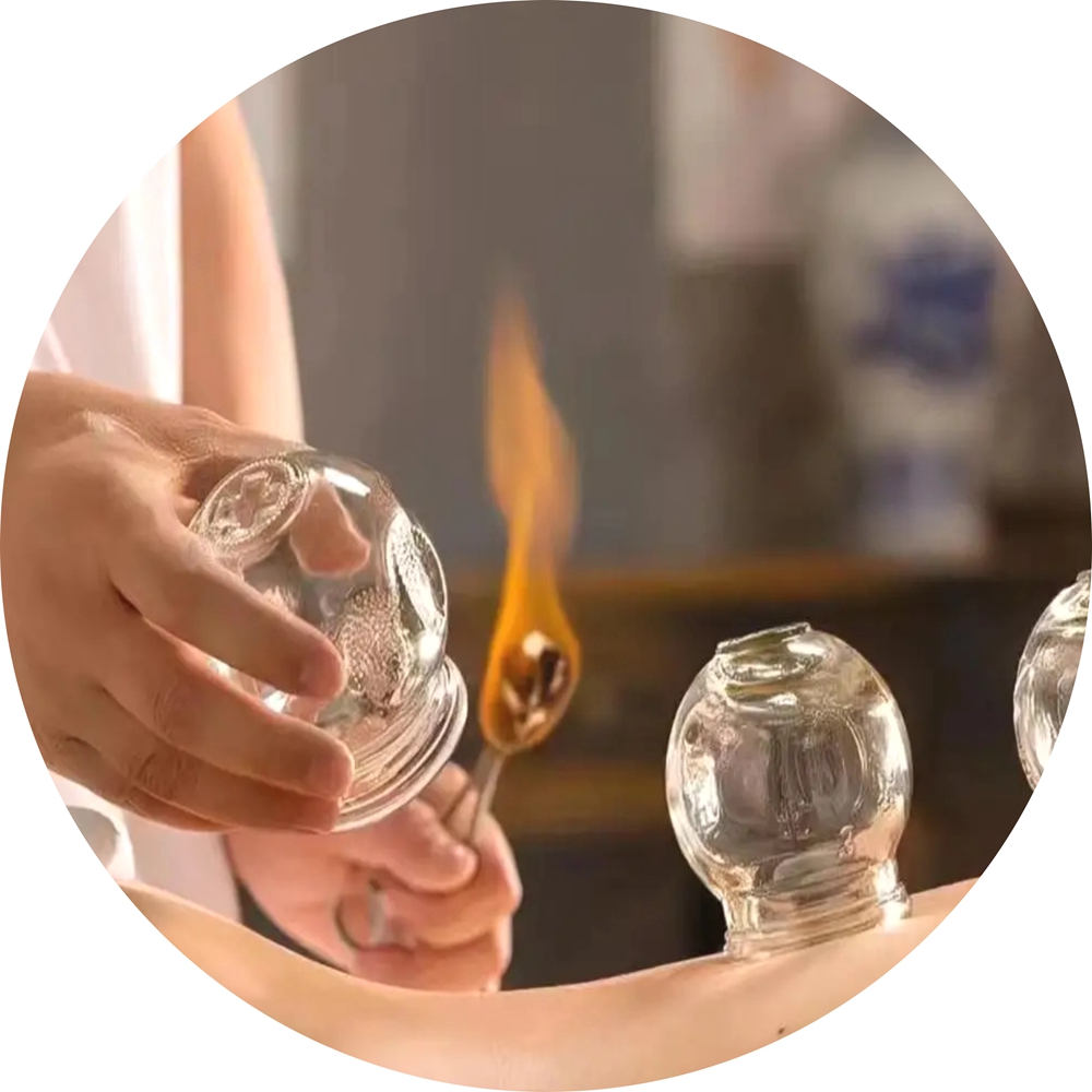 Cupping